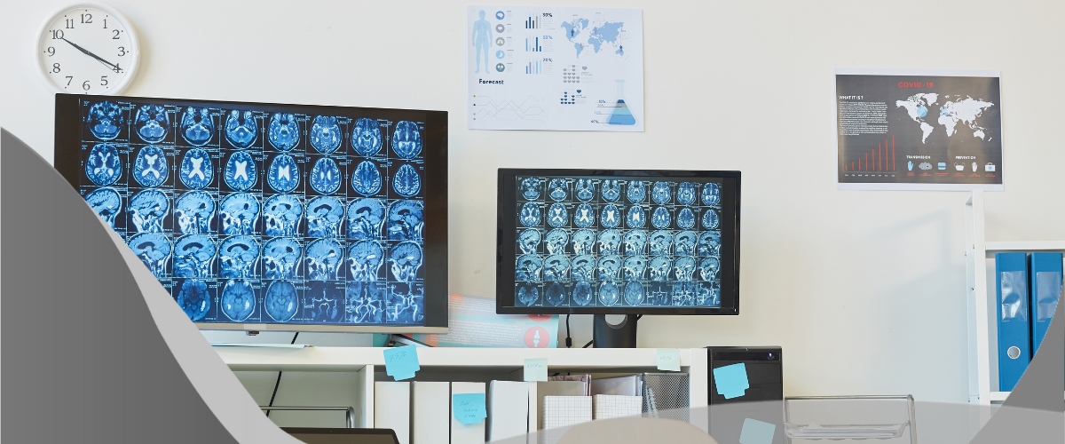 Angiotomografia - sala com 2 telas de computadores apresentando exames de imagem