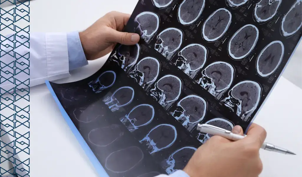 neuroimagem